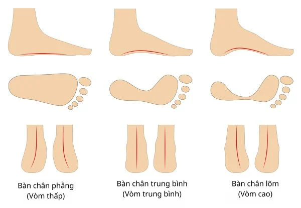 cau truc ban chan chon giay